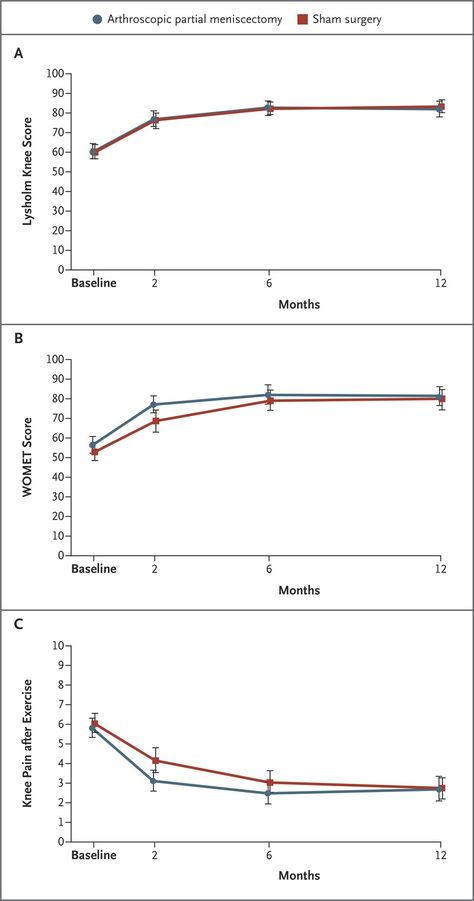 Arthroscopic Partial Meniscectomy versus Sham Surgery for a Degenerative Meniscal Tear | NEJM Meniscal Tear, Shear Force, Double Blinds, Platelet Rich Plasma, Lower Limb, Medicine Journal, Meta Analysis, Calf Muscles, Knee Pain