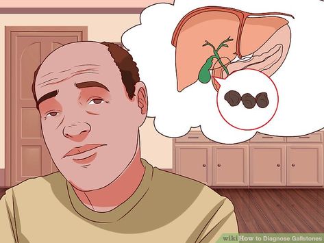 How to Diagnose Gallstones (with Pictures) - wikiHow Gallbladder Attack Symptoms, Gallbladder Attack, Bile Duct, Post Workout Recovery, Stone Pictures, Abdominal Pain, Blood Test, Educational Websites, A Lot Of People