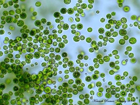 Light signals algae to stick on surfaces | Microbiology Microscopic Algae, Micro Organisms, Sea Monkeys, Galapagos Tortoise, Linkedin Banner, Green Algae, Organic Art, Microscopes, Azzedine Alaia