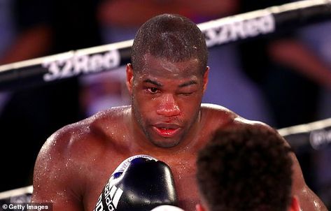 Daniel Dubois could have had his career ended if he didn't take a knee against Joe Joyce Joe Joyce, Latest News Today, Nerve Pain, Sports Clubs, What’s Going On, One In A Million, His Eyes, Boxing