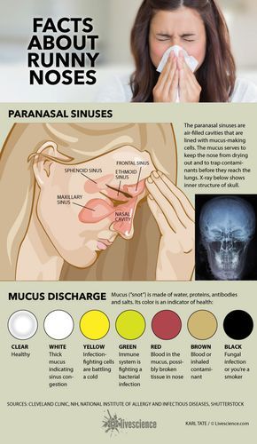 Diagram of sinuses and chart of mucus colors. Mucus Color, Paranasal Sinuses, Medical Knowledge, Runny Nose, Health Plan, Health Info, Health Advice, Health Facts, Health Remedies