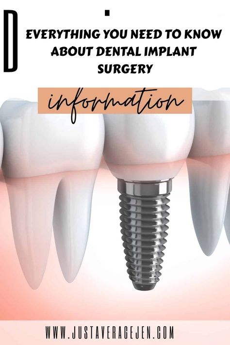 Everything you need to know about dental implant surgery and the options you have for it so it can benefit you in the long term Dental Implants Creative Ads, Tooth Bridge, Dental Implant Procedure, Dental Implant Surgery, Pinterest Tutorials, Teeth Implants, Bone Loss, Dental Implant, Natural Teeth