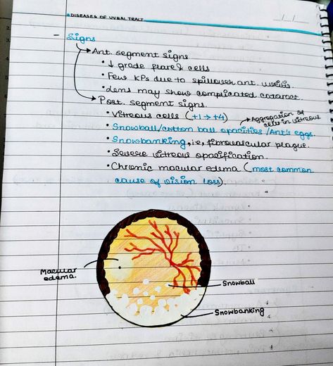 Handwritten medical notes. Aesthetic note taking. Ophthalmology notes Ophthalmology Notes, Medical Notes Aesthetic, Aesthetic Note, Medical Notes, Notes Aesthetic, Aesthetic Notes, Vision Loss, Career Options, Cotton Ball