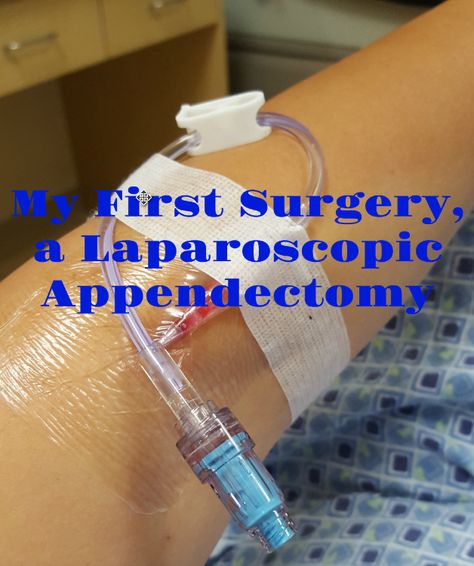 My First Surgery, a Laparoscopic Appendectomy Appendix Surgery Recovery, Laparoscopic Surgery Recovery, Appendectomy Recovery, Appendix Surgery, Gas Relief, Robotic Surgery, Laparoscopic Surgery, Food Poisoning, Surgery Recovery