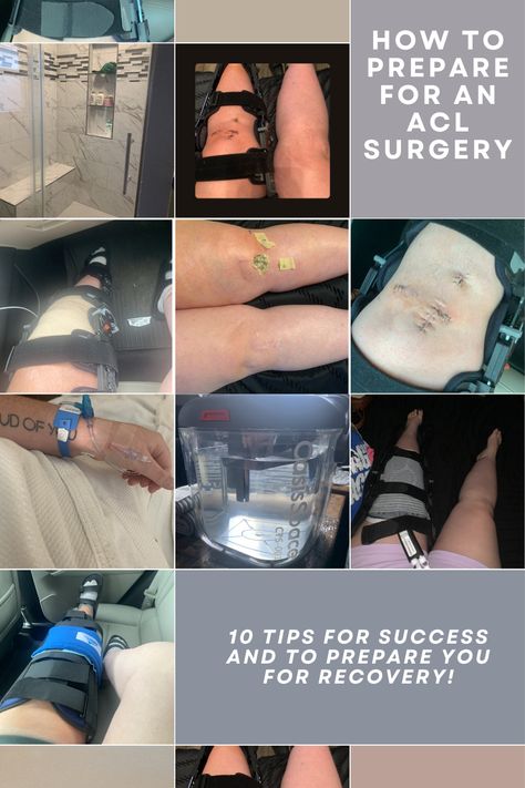 ACL Surgery is a tough mental and physical battle. Let me take you on my journey from my ACL Surgery in June 2024! Acl Recovery Timeline, Acl Aesthetic, Torn Ligament In Knee, Acl Surgery Recovery, Surgery Prep, Meniscus Surgery, Acl Knee, Knee Surgery Recovery, Acl Recovery