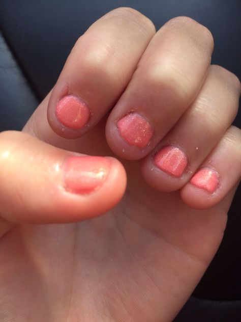 Short Bitten Nails, Bitten Nails, Finger Nails, Nail Biting, Nails For Kids, Toe Nails, Short Nails, Nail Designs