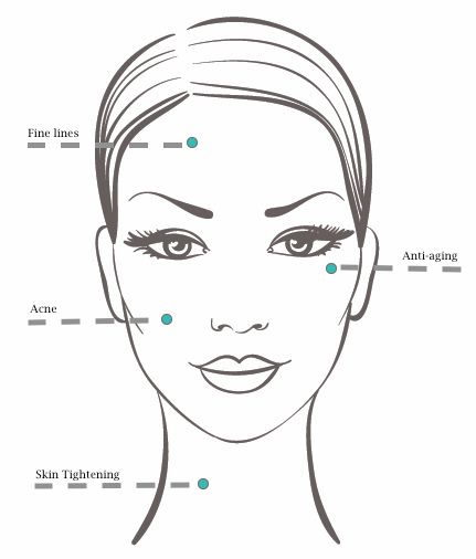 Face and Neck areas of MESO Pure application. Mesotherapy treatments. Female Face Drawing, Face Template, Makeup Face Charts, Face Chart, Drawing Faces, Body Reference Drawing, Face Sketch, Face Photography, Realistic Drawings