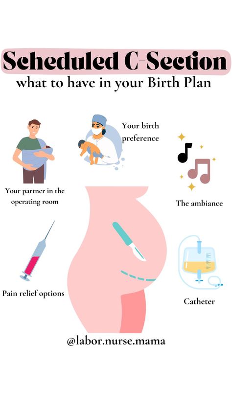 From a labor and delivery nurse's perspective, here's a gentle guide for those of you planning a scheduled C-section. It's a unique journey, and having a birth plan tailored to your needs can make all the difference.⁠ Scheduled C Section, Pregnancy Checklist, Labor Nurse, Labor And Delivery Nurse, Nurse Aesthetic, Umbilical Cord, Medical Careers, Birth Labor, Labor Delivery