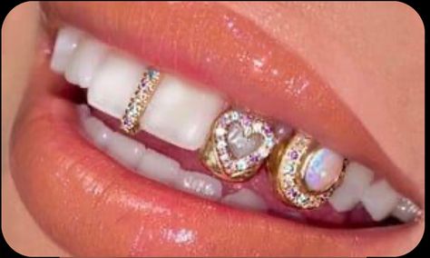 Girls With Grills, Girl Grillz, Designer Jewelery, Dental Jewelry, Grillz Teeth, Diamond Teeth, Gold Grillz, Grills Teeth, Tooth Gem