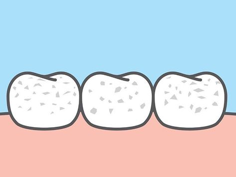 When we think of stains on teeth we normally think of dark colors. Read this week's blog to learn more about what causes white spots and how we can help remove them!  . #dentistry #whitespots #smile #dentist #blog #dentalblog #cosmeticdentistry #teeth #dental #dentalcare #dentalhealth #dentista #dentistryworld Dental Fluorosis, Zoom Teeth Whitening, Smile Dentist, Tooth Enamel, Dental Center, Cosmetic Dentistry, Dental Health, Dental Care, Teeth Whitening