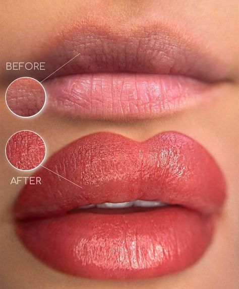 Can You Kiss After Lip Blush? How Long Should You Wait Cosmetic Lip Tattoo, Lip Permanent Makeup, Lip Blushing, Permanent Lipstick, Coral Lips, Lip Blush, Semi Permanent Makeup, Ingrown Hairs, Ombre Lips