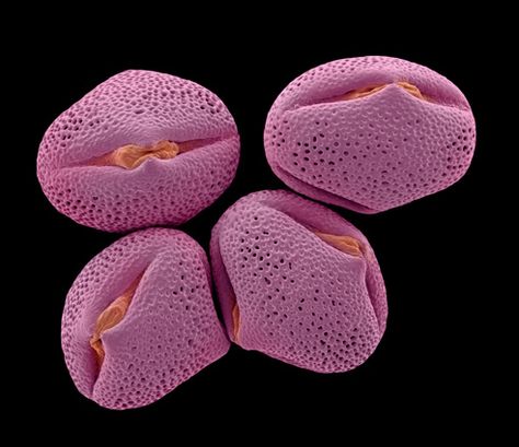 Cercis siliquastrum, Judas tree pollen  [Rob Kesseler] by Center for Image in Science and Art _ UL, via Flickr Microscopic Creatures, Flower Reproduction, Judas Tree, Microscopic Photography, Micro Photography, Philosophy Of Science, Microscopic Images, Organic Structure, Macro Photos