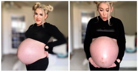 Woman pregnant with twins gets pregnant with third baby 10 days later Short Pregnant Women, Huge Pregnant, Getting Pregnant With Twins, Short Height, Pregnant With Twins, Premature Birth, Natural Pregnancy, Unborn Baby, Twin Pregnancy