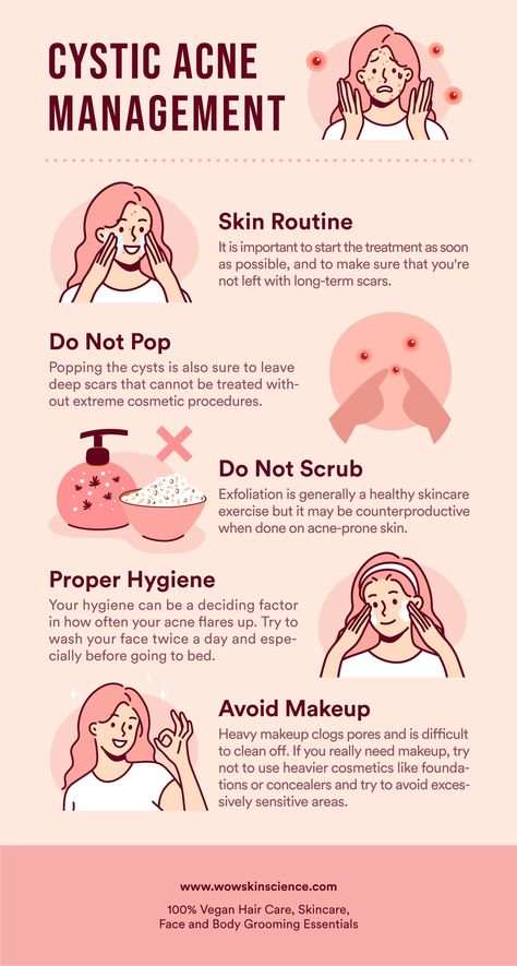 Get Rid Of Cystic Acne, Natural Remedies For Acne, Treating Cystic Acne, Clear Healthy Skin, Types Of Acne, Natural Acne Remedies, Skin Science, Clearer Skin, Cystic Acne