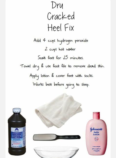 Dry cracked heels: causes, prevention, remedies and treatments Pedicure Ideas Winter, Cracked Heels Diy, Diy Pedicure Soak, Cracked Heel Remedies, Pedicure Soak, Dry Cracked Heels, Dry Heels, Cracked Heel, Diy Pedicure