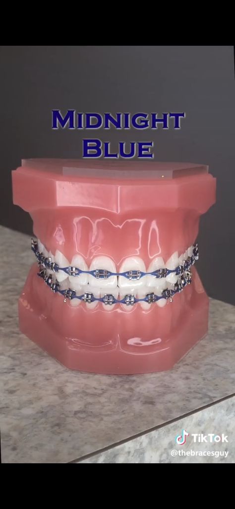 Dark Blue Power Chain Braces, Blue Braces Colors, Braces Colors With Rubber Bands, Royal Blue Braces Teeth, Braces Blue, Halloween Braces, Navy Blue Braces Teeth, Royal Blue Braces, Blue Braces