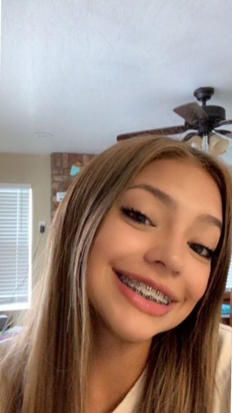 Blonde With Braces, Pretty Girls With Braces Blonde Hair, Pretty Mexican Girls With Braces, Braces Aesthetic Girl, Latina With Braces, Baddies With Braces, Braces Selfie, Pretty Braces, People With Braces