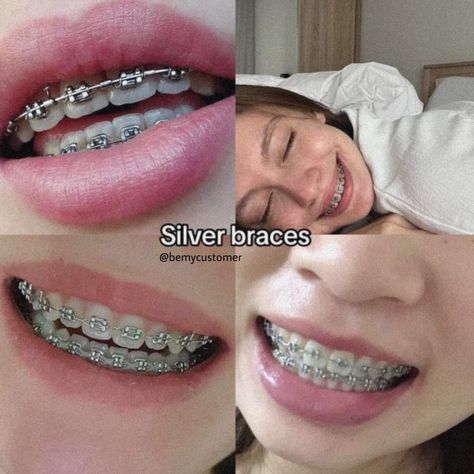 Braces With No Color, Braces On Small Teeth, Grey Braces Color, Braces Colors Lavender, Silver Braces Color, Braces Inspo Aesthetic, Clear Braces Aesthetic, Cute Braces Colors For Brown Skin, Braces Colors That Make Teeth Look White