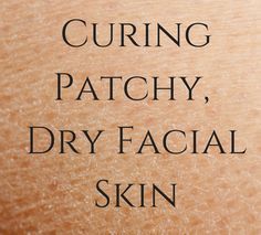 Curing Patchy Dry Facial Skin Dry Patchy Skin, Dry Facial Skin, Patchy Skin, Facial For Dry Skin, Dry Skin Remedies, Dry Skin Patches, Combo Skin, A Muse, What To Use