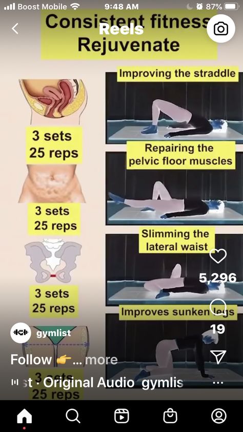 Repair Pelvic Floor Muscles, Pelvic Floor Muscles, Boost Mobile, Pelvic Floor, Arm Workout, Abs Workout, Muscles, Repair, Health