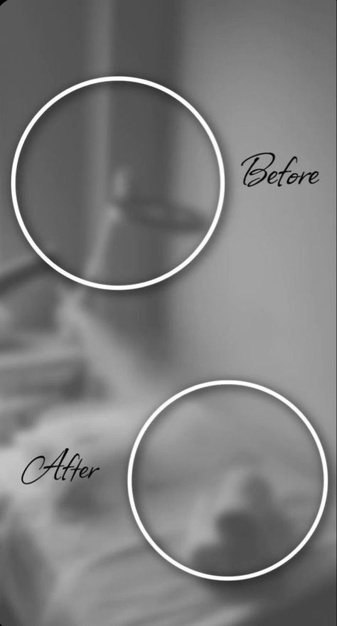 Before and After Template graphicdesignuilogo Care Logo Design Ideas, Skin Care Logo Design Ideas, Before And After Template, Skin Care Logo Design, Skin Care Logo, Care Logo Design, Free Business Logo, Logo Options, Small Business Logo