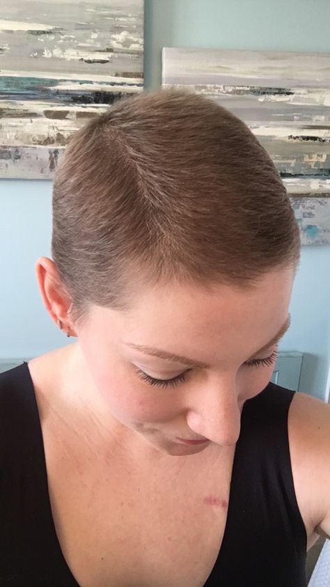 Growing Hair After Chemo Style, Short Hairstyles After Chemo, Chemo Pixie Haircut, Chemo Grow Out, Short Hair Styles After Chemo, Short Hair For Chemo Patients, Pixie Haircut After Chemo, Short Hair Widows Peak Women, Short Hairstyle Women After Chemo