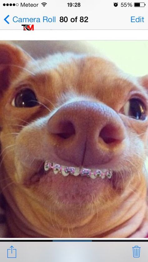 Cat With Braces, Baby Pink Braces, Colored Braces, Braces Humor, Tuna Dog, Pink Braces, Dog Crossbreeds, Cute Braces, Animal Caricature