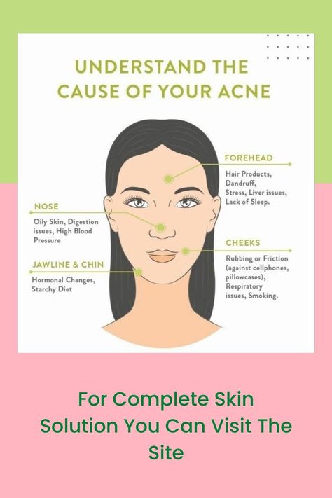 Causes of Acne & Home Remedies Acne Home Remedies, Causes Of Acne, Forehead Hair, Liver Issues, Home Remedies For Acne, Acne Causes, Acne Solutions, Acne Remedies, Hormonal Changes