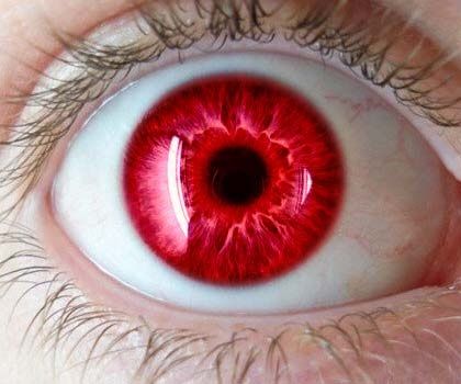 bloodshot eyes Red Iris, Iris Eye, Rare Eyes, Eyes Artwork, Eye Pictures, Produk Apple, 흑백 그림, Red Eye, Aesthetic Eyes