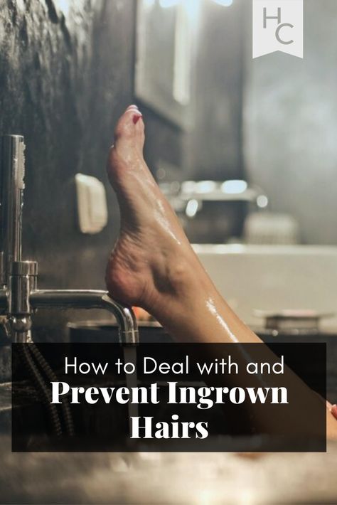 How to Deal With & Prevent Ingrown Hairs Treat Ingrown Hair, Hair Trap, Natural Skin Care Remedies, Prevent Ingrown Hairs, Ingrown Hairs, Healthy Travel, Money Advice, Choppy Hair, Bob Hairstyles For Fine Hair