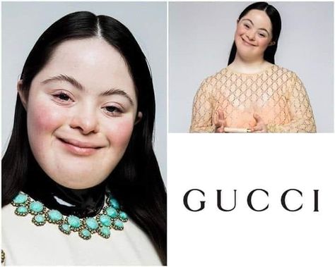 This is Ellie Goldstein, who has become the new Gucci model. First one with down syndrome.

Respect to the brand for tolerance and treating every human being equal. This is also an act of love, showing beauty in every person. ❤ Subway Baby, Show Beauty, Gucci Model, Influential People, Gucci Models, Skin Care Remedies, Human Being, Human Anatomy, Father And Son