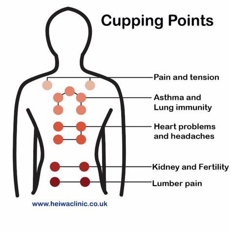 Hijama Points, Cupping Points, Affinity Photo Tutorial, Somatic Movement, Hijama Cupping, Full Body Massage Techniques, Massage Therapy Business, Body Massage Techniques, Cupping Massage