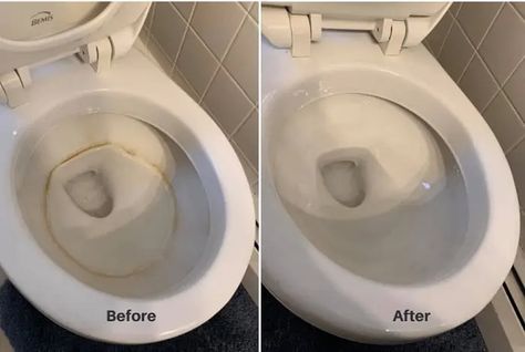 How To Clean Toilet Bowl Ring Clean Toilet Ring, Clean Toilet Bowl Ring, Cleaning Toilet Ring, Toilet Ring Remover, Clean Toilet Bowl Stains, Toilet Bowl Ring, Ring Cleaner, Toilet Bowl Stains, Remove Yellow Stains