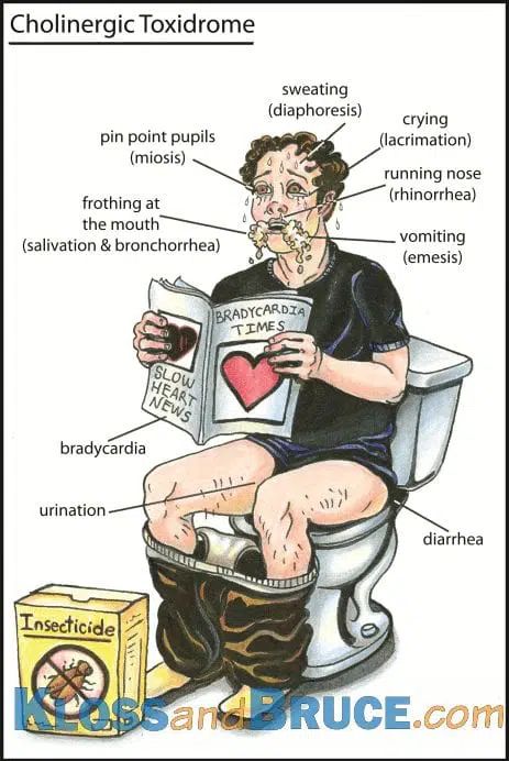 Cholinergic Toxidrome • LITFL • Toxicology Flashcards Paramedic School, Nursing Mnemonics, Medical Student Study, Pharmacology Nursing, Nursing School Survival, Nursing School Studying, Nursing School Tips, Medical School Studying, Nursing School Notes