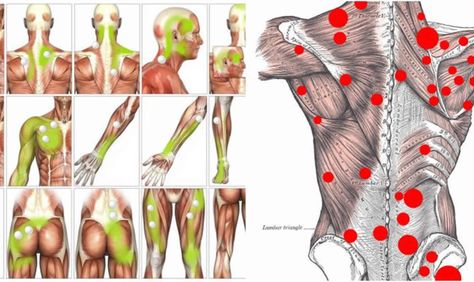 Trigger Points Neck, Myofascial Release Massage, Fascia Stretching, Punkty Spustowe, Trigger Point Release, Myofascial Pain Syndrome, Trigger Point Massage, Musculoskeletal Pain, Trigger Point Therapy