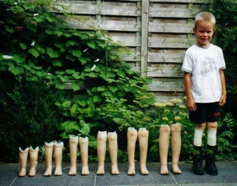 Growth from a different perspective Growth Photography, Prosthetic Leg, Parenting Fail, Never Grow Up, Different Perspectives, Family Humor, Human Art, Video New, Inspirational People