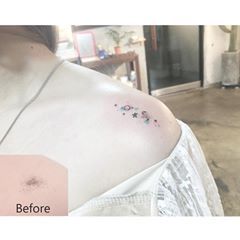 Mole -> universe Tattoo Covering, Playground Tattoo, Universe Tattoo, Tattoo Cover Up, Tattoo Cover, Tattoo Cover-up, Minimalistic Style, Tattoo On, Mole