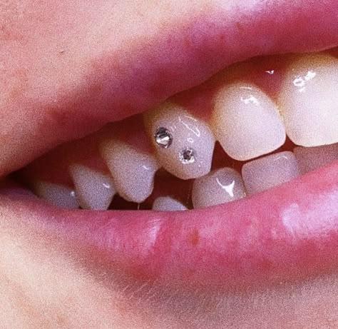 Simple Tooth Gem Designs, Simple Tooth Gems Ideas, Teeth Gems Aesthetic, Piercing Dental, Heart Tooth Gem, Tooth Gems Ideas, Teeth Diamond, Teeth Gems, Dental Jewelry