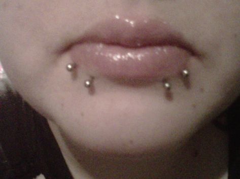 Double Spider Bites Or Double Snake Bites Piercing Piercing Mouth, Different Lip Piercings, Lip Cuffs, Snake Bite Piercing, Spider Bite Piercing, Mouth Piercings, Lip Piercings, Spider Bites, Face Piercings