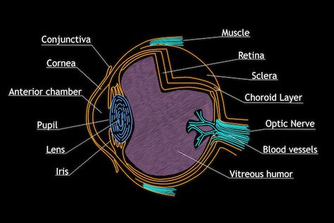 Early warning signs of a torn or detached retina | Catching Health with Diane Atwoo Detached Retina Symptoms, Posterior Vitreous Detachment, Retina Surgery, Optic Nerve, Eye Exam, Eye Surgery, Natural Therapy, Daily Meditation, Healing Process