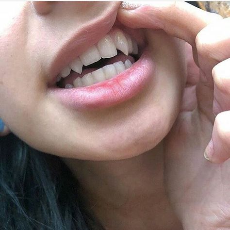 casual fangs Canine Teeth Human Aesthetic, Sharp Canine Teeth Human, Teeth Aesthetic, Fake Injury, Canine Tooth, Perfect Teeth, Vampire Fangs, Vampire Teeth, Vampire Girls