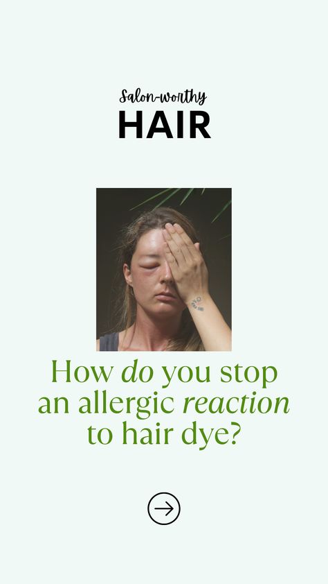 I’ll explain everything you need to know about patch tests and how to do them at home correctly. Hair Dye Allergy, Color Treated Hair Care, How To Dye Hair At Home, Hair Color Guide, Allergy Testing, Color Guide, Scalp Health, Allergic Reaction, Color Treated Hair