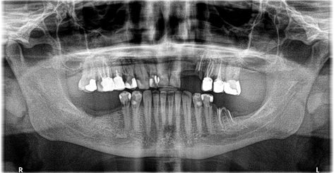 Dental x-ray Dental Radiography, Tooth Pain, Nerve Damage, Dental Procedures, Dental Clinic, Dental Health, Dental Care, About Uk, Antonio Mora Artwork