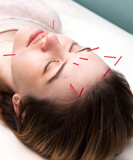 Facial acupuncture for great-looking skin Facial Acupuncture, Salsa Bechamel, Skin Growths, Face Cream Best, Natural Anti Aging, Ancient Beauty, Anti Aging Tips, Best Face Products, Simple Skincare