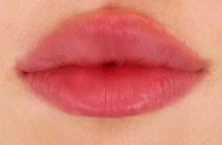 Lips Inspiration, Lip Filler, Perfect Lips, Rosy Pink, Beauty Goals, Lip Fillers, Beautiful Lips, 2023 Vision, Pink Lips