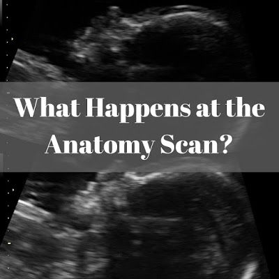 The anatomy scan typically happens between 18 to 21 weeks, but usually, they aim for 20 weeks (which is why you will hear it called the ... Pregnant Ultrasound, 20 Week Scan, 21 Weeks Pregnant, 20 Weeks Pregnant, Ultrasound Pictures, All About Pregnancy, Millennial Mom, Pregnancy Information, 20 Weeks