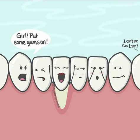 Hehe I love this! Dentist Jokes, Dentistry Humor, Dental Quotes, Dental Posts, Dental Jokes, Dental Hygiene School, Dental Anatomy, Dental Fun, Gum Recession