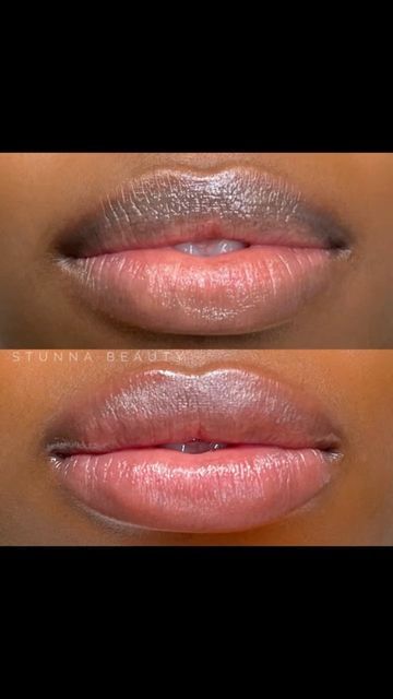 Lip Blushing On Dark Skin, Lip Blush On Dark Lips, Dark Lip Neutralization, Lip Blushing Tattoo Before And After Black Women, Lip Blush Black Women, Lip Blushing Tattoo Colors Dark Skin, Lip Blushing Tattoo Before And After Natural, Lip Neutralization Before And After, Lip Blushing Black Women