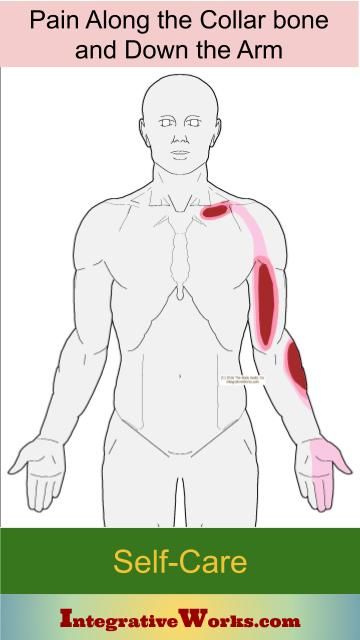 Pain in the Torso and Arm: Signs, Self-care, Therapy Notes... - Integrative Works Neck And Collar Bone Exercise, Shoulder Pain Remedies, Infraspinatus Muscle, Thoracic Outlet, Therapy Notes, Forward Head Posture, Camel Pose, Color Bone, Trigger Point