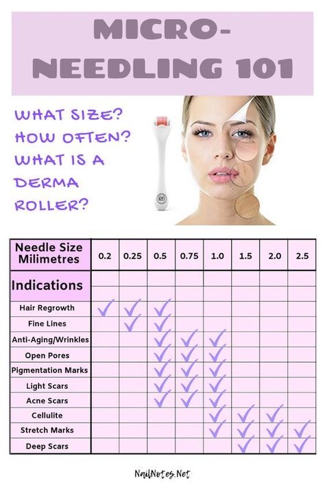 Derma Roller Results, Derma Roller Before And After, Collage Face, Skin Roller, Micro Needling, Micro Needle Roller, Micro Needle, Skin Aesthetics, Collagen Booster